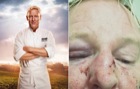 Muslims beat a famous anti-racist Swedish chef within an inch of his life because he looks like Donald Trump