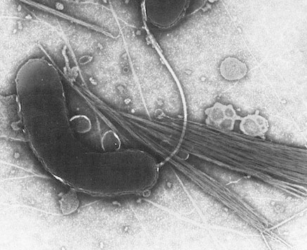 An electron microscope image of Vibrio cholerae, which is the bacteria that is responsible for the gastroinestinal disease cholera.   Cholera is caused by the bacteria being consumed and reaching the small intestine.